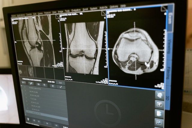 Millora de la sol·licitud de ressonàncies magnètiques de genoll en atenció primària mitjançant indicacions adequades: un projecte de millora de la qualitat.