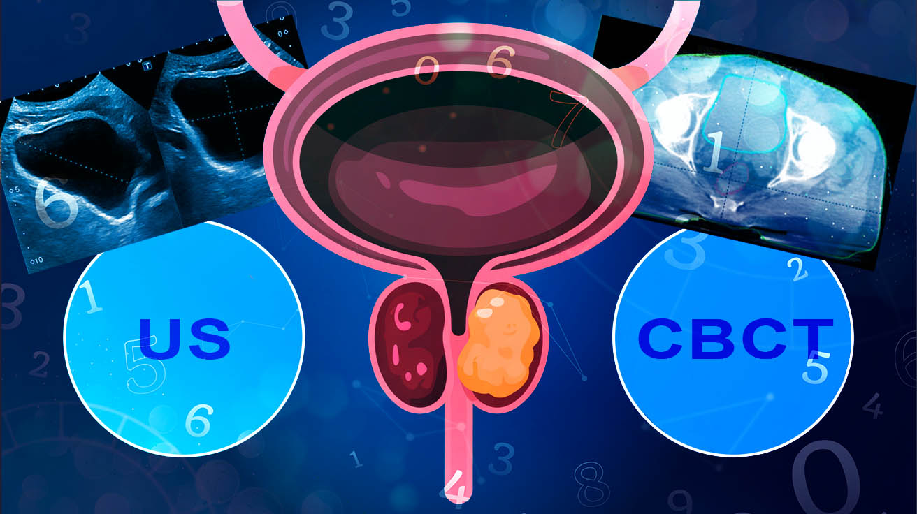 Avaluació crítica d'un estudi prospectiu de l'avaluació del volum de la bufeta mitjançant ultrasò a la radioteràpia del càncer de pròstata: Comparació amb la tomografia computada de feix cònic (CBCT).